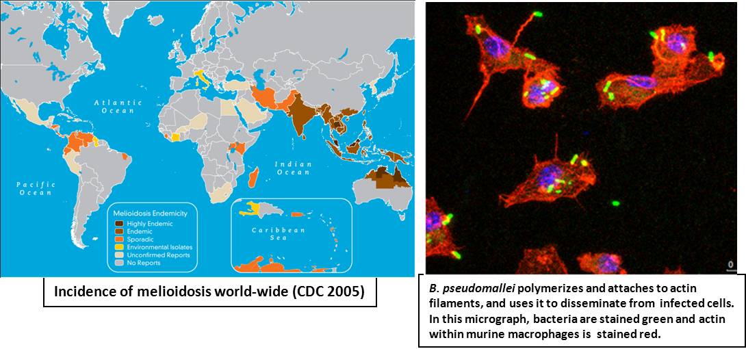 Wooten Melioidosis photo