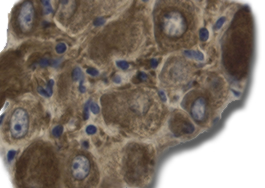 Mouse Cardiac Ganglion 