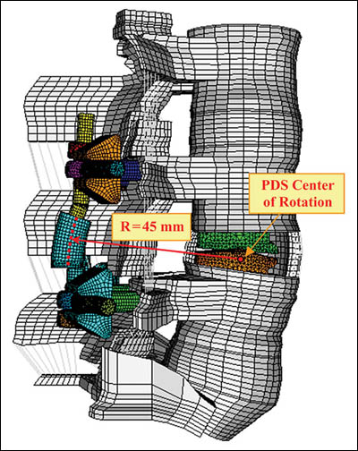 Finite Element Spine