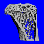 Mouse Proximal Tibia