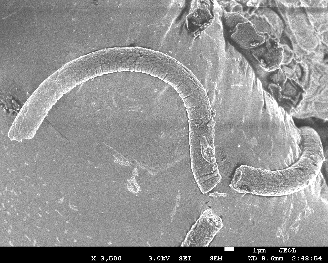 bacteria4