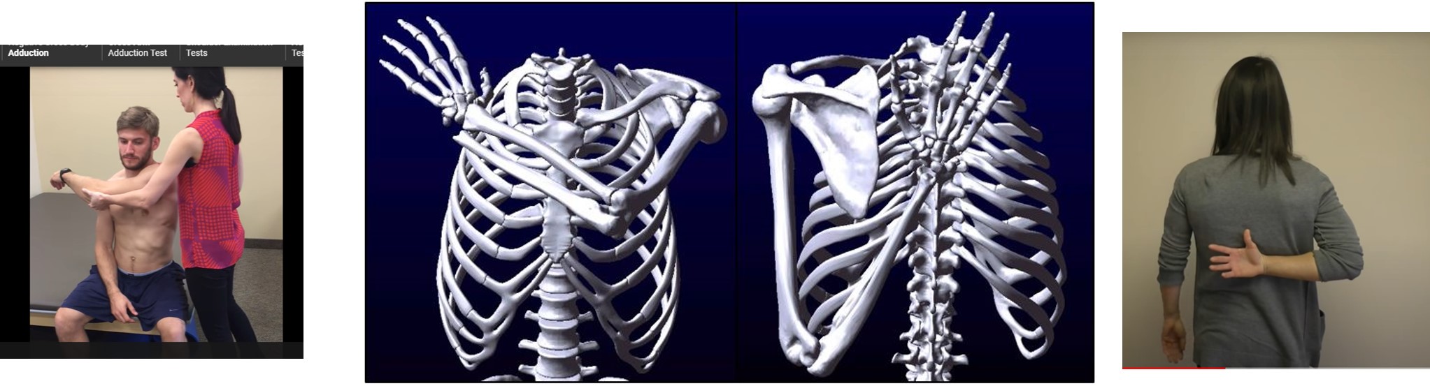 demonstration of cross body adduction test and frozen shoulder test