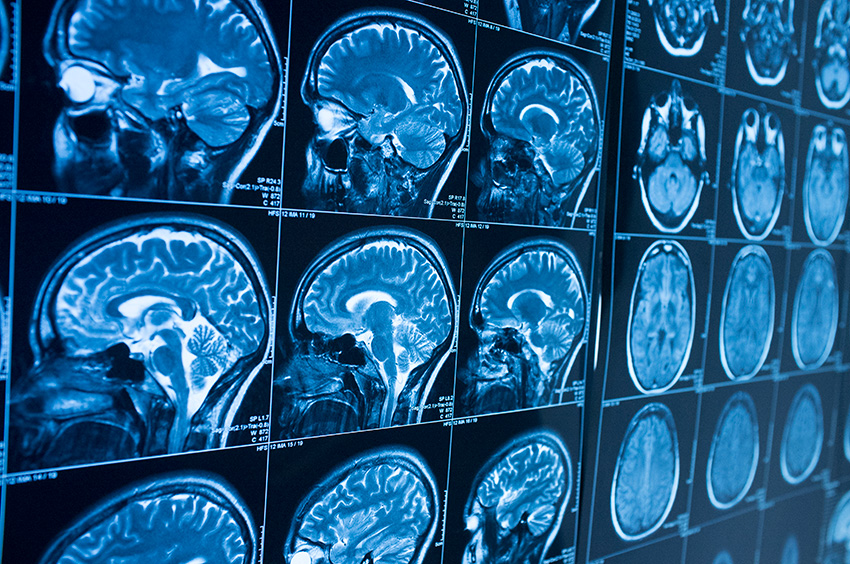 A grid of images showing different layers of a human brain