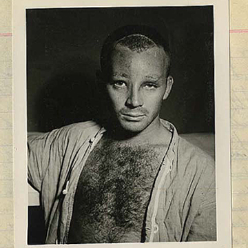 Post-operation photograph of Robert Brown