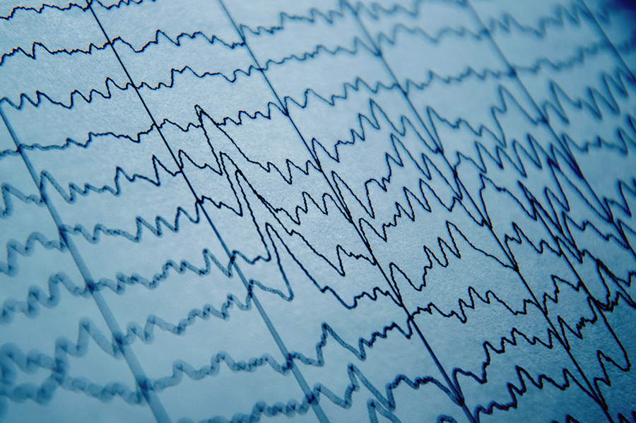 EEG wave in human brain