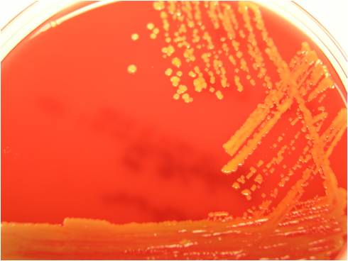 microbacterium