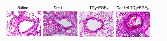 eicosanoids