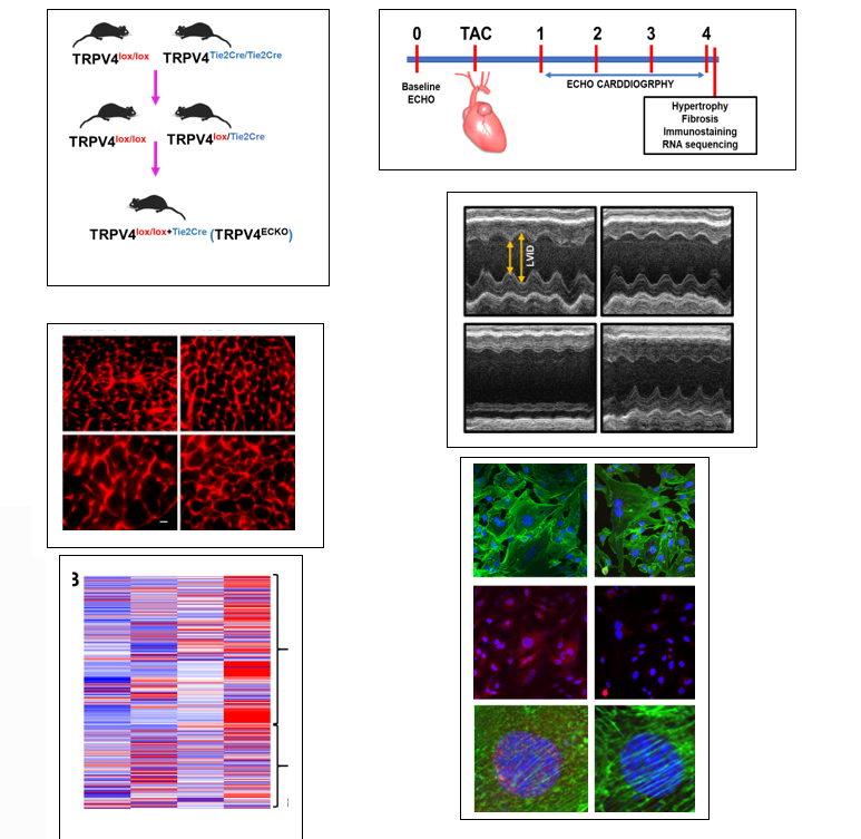 angiogenesis