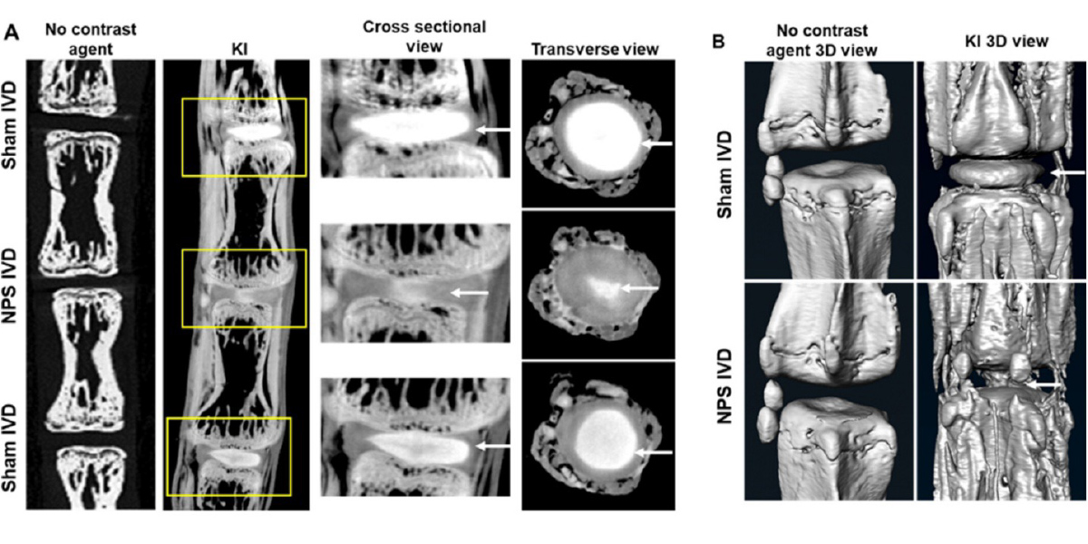 High-Resolution 3-Dimensional Micro-CT Imaging of Intervertebral Discs Using a Novel Contrast Agent