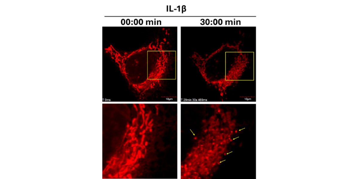ERK1/2-mediated activation of DRP1 regulates mitochondrial dynamics and apoptosis in chondrocytes
