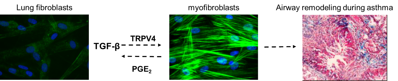 lung fibroblasts