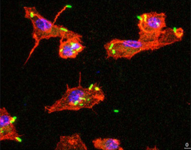 Microscopy image showing Burkholderia pseudomallei bacteria in green interacting with red-stained actin inside mouse macrophages.