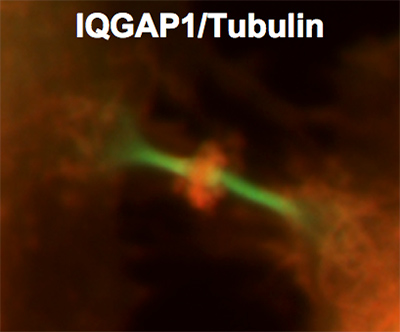 Image of IQGAP1/Tubulin